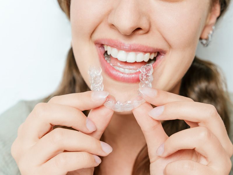 Clear Correct é bom alinhador