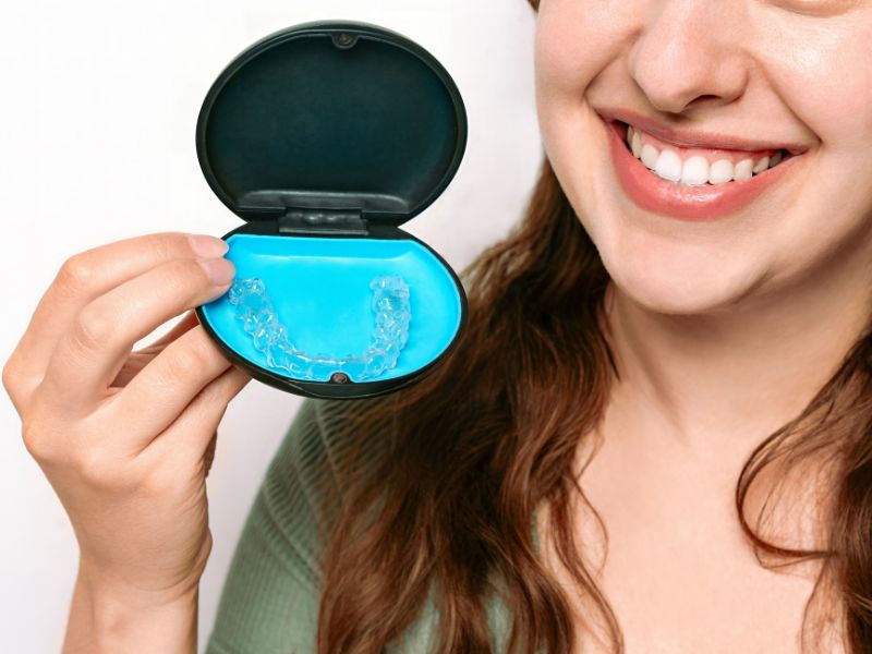 alinhadores dentais preço conceito