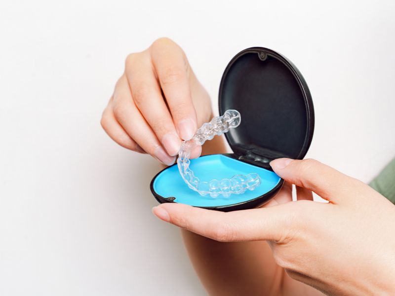 melhor alinhador invisível escolha