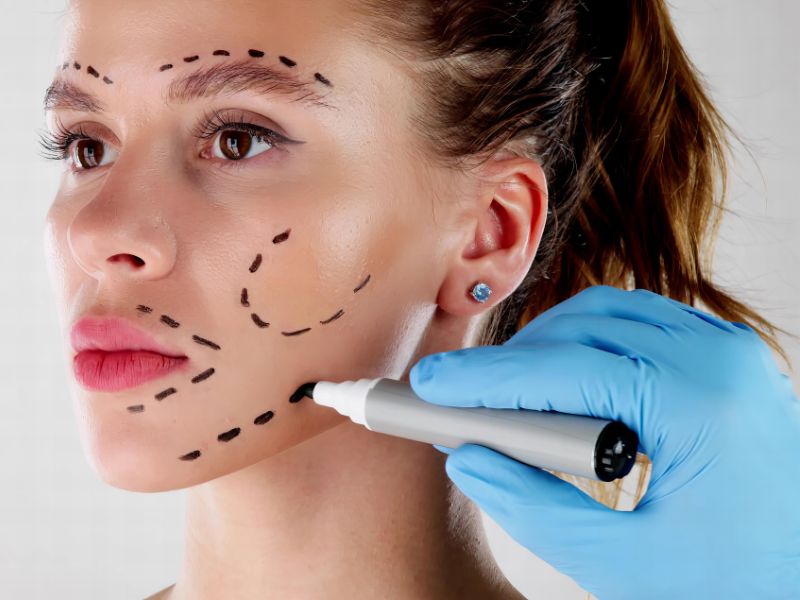 melhor harmonização facial do Brasil tendências