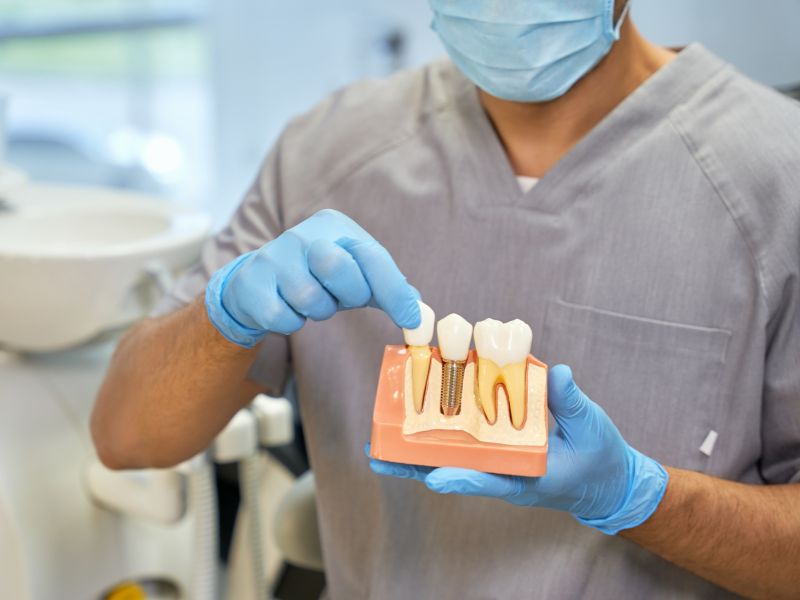 quanto custa um implante dentário em brasília clínica