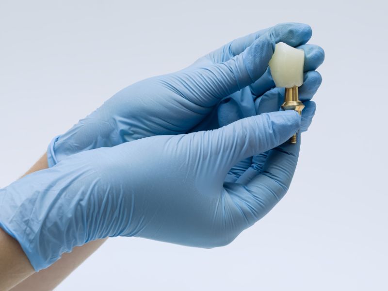 quanto custa um implante dentário em brasília preço