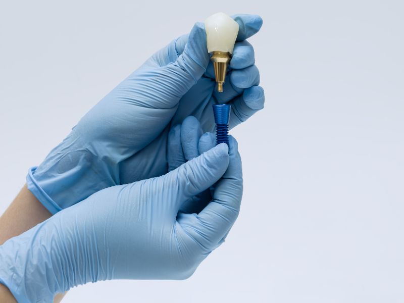 tipos de implante dentário opções