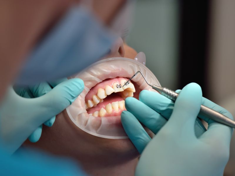 melhores dentistas de brasília benefícios