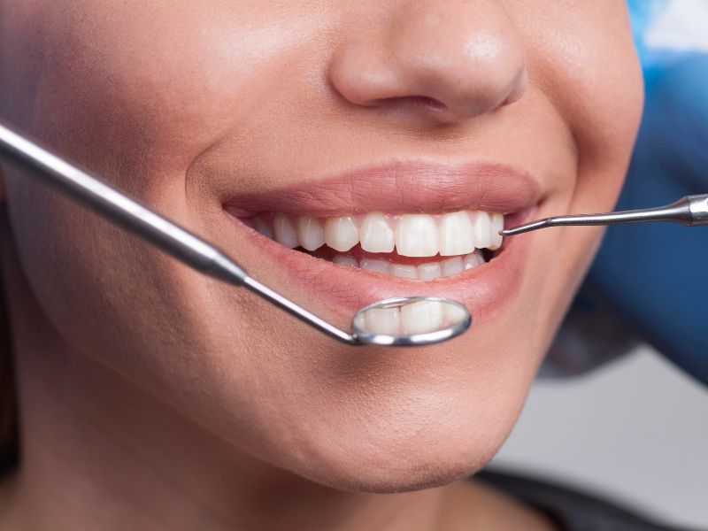 melhores dentistas de brasília importância