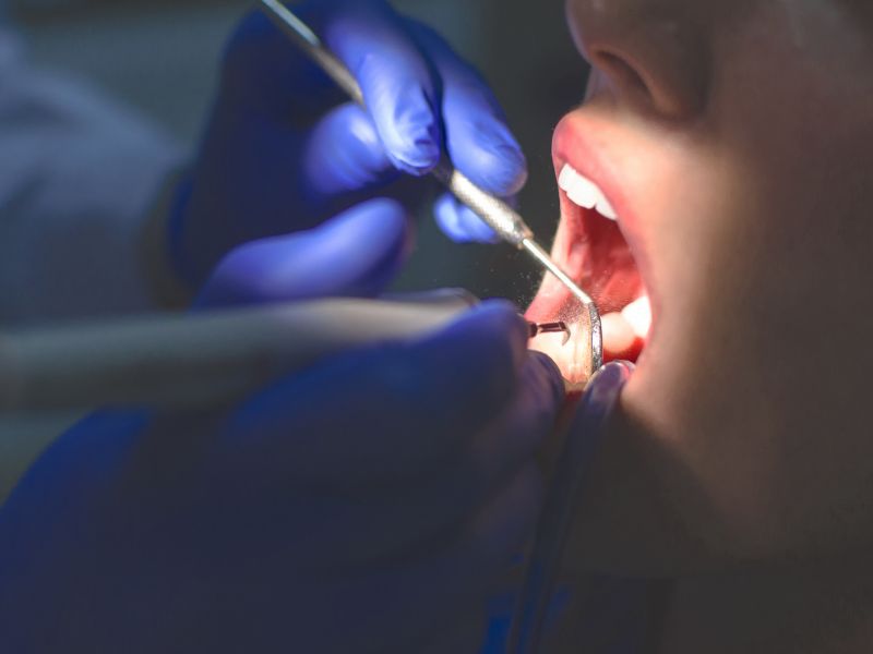 melhores dentistas de brasília