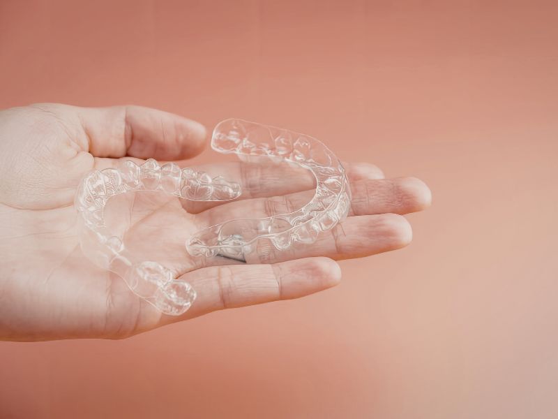 aparelho transparente móvel preço